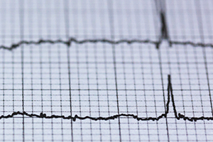 Printout of an EKG, a seismograph, or a polygraph.
